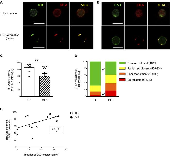 BTLA is poorly recruited to TCR clusters upon activation in lupus CD4+ T...