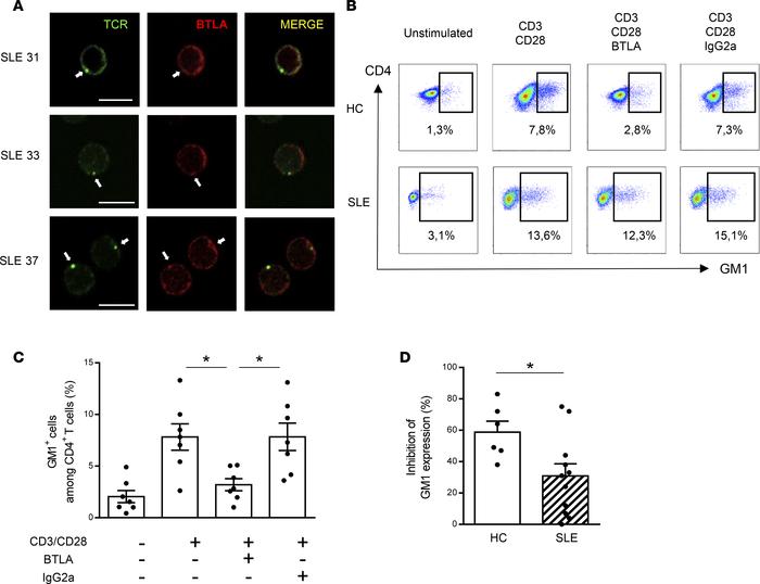 BTLA regulates GM1 expression in activated T cells.
(A) Unstimulated lup...